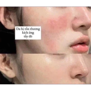 Kem B5 Prettyskin 1.5ml Mini - Dưỡng ẩm, phục hồi dịu da, giảm giá 22% chỉ 45.000 VND 6 Kem B5 Prettyskin 1.5ml Mini - Dưỡng ẩm, phục hồi dịu da, giảm giá 22% chỉ 45.000 VND 6