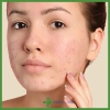 Kem Benzoyl Peroxide 5%/10% EZOYB Giảm Mụn Trứng Cá Nhanh, Hiệu Quả, Giá 44.842₫ 2