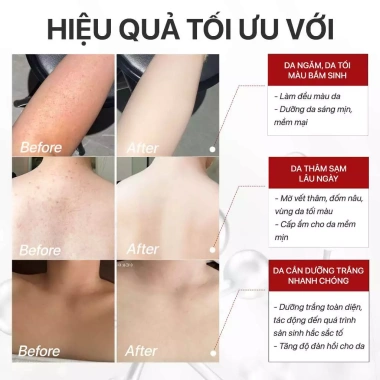 Kem Body Alpha Arbutin Khử Sắc Tố Vàng, Dưỡng Trắng Da Niacinamide & Kojic Acid - Công Thức Khoa Học