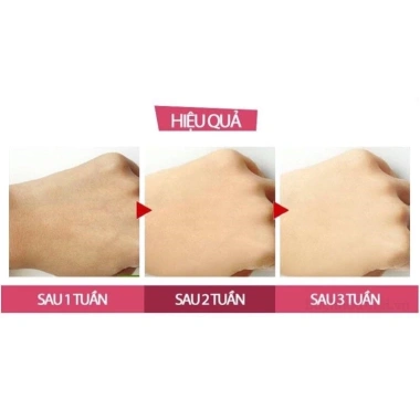 Kem Body Sirum Alpha Arbutin Trắng Da UV Protection 500g Giá chỉ 59.000 VND