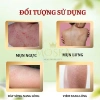 Kem Bôi Da Liễu Urea - Xử Lý Viêm Nang Lông, Dây Sừng, Mụn, Sáng Mịn & Căng ẩm - 90k 4