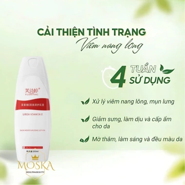 Kem Bôi Da Liễu Urea - Xử Lý Viêm Nang Lông, Dây Sừng, Mụn, Sáng Mịn & Căng ẩm - 90k 8