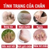 Kem bôi da Ngứa ghẻ lâu năm 180k - Giảm còn 150k, trị nấm, tổ đỉa, hắc lào, mề đay, muỗi đốt 5