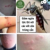 Kem bôi da Ngứa ghẻ lâu năm 180k - Giảm còn 150k, trị nấm, tổ đỉa, hắc lào, mề đay, muỗi đốt 7