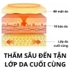 Kem Bôi Hết Đau Nhức Xương Khớp Gout Ointment Giảm Đau Nhanh, Đỡ Dai 749k 7