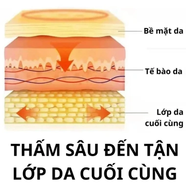 Kem Bôi Hết Đau Nhức Xương Khớp Gout Ointment Giảm Đau Nhanh, Đỡ Dai 749k