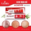 Kem Bôi Mụn ACNEVIR SANTAFA 15g - Giảm Mụn Cám và Đầu Đen, Giá Ưu Đãi 77.900₫ 4