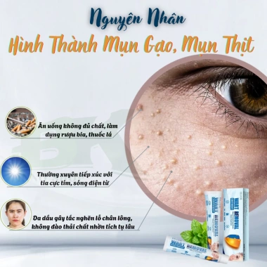 Kem Bôi Mụn Thịt EELHOE 20ml - Bóc Tách Mụn Cóc, Không Thâm Sẹo, Ngừa Tái Phát - BK INNO - Giá 89.000đ 3