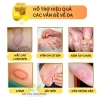 Kem Bôi Nấm Ngứa Bọ Cạp Vàng Ông Lão 20g Giảm Ngứa Nhanh Giá 29.990 VND 3