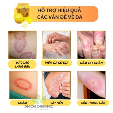 Kem Bôi Nấm Ngứa Bọ Cạp Vàng Ông Lão 20g Giảm Ngứa Nhanh Giá 29.990 VND 3