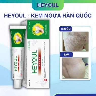 Kem bôi ngoài da HEYOUL Hàn Quốc trị sừng, chàm, nấm hắc lào, viêm da - 75.000₫