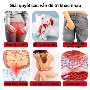Kem bôi trĩ gel Nhật Bản 20g - Loại bỏ trĩ nội, ngoại, ngứa ra máu, giảm sưng 5 Kem bôi trĩ gel Nhật Bản 20g - Loại bỏ trĩ nội, ngoại, ngứa ra máu, giảm sưng 5