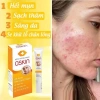 Kem bôi Zeskin Meskin Ery mụn trứng cá thâm đỏ, mụn đầu đen, da sáng chỉ 45.000đ 9
