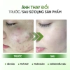 Kem Cao Khổ Qua 10ml Dành Cho Nữ - Giảm Mụn Hiệu Quả, Dưỡng Da Sáng Mịn 7