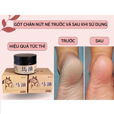 Kem cao ngựa bôi nứt nẻ gót chân, tay siêu mền an toàn - Giá ưu đãi 19.700đ