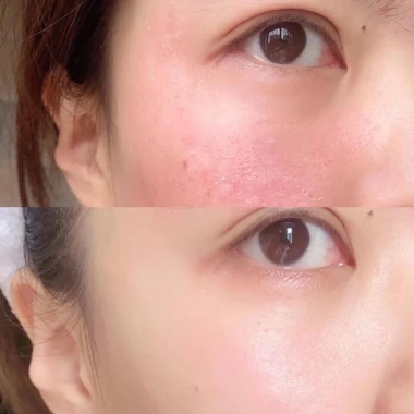 Kem Cấp Ẩm Phục Hồi Da Tế Bào Gốc Rebloom Luxury 100g - Chống Lão Hóa, Giá 640k 5 Kem Cấp Ẩm Phục Hồi Da Tế Bào Gốc Rebloom Luxury 100g - Chống Lão Hóa, Giá 640k 5