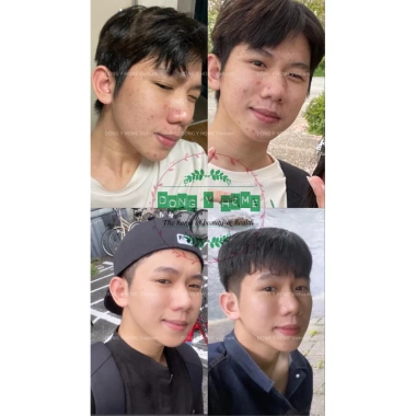 Kem Chấm Mụn Đông Y Home 20g - Giảm Thâm, Làm Đẹp Da, Skincare, Giá 197.160 VND 6