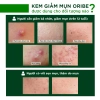 Kem Chấm Mụn Oribe 20g - Dưỡng da, giảm thâm sẹo, kiểm soát dầu nhờn, 55.800 VND 7