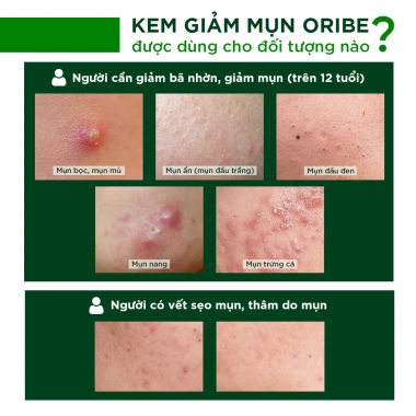Kem Chấm Mụn Oribe 20g - Dưỡng da, giảm thâm sẹo, kiểm soát dầu nhờn, 55.800 VND