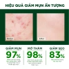 Kem Chấm Mụn Oribe 20g - Dưỡng da, giảm thâm sẹo, kiểm soát dầu nhờn, 55.800 VND 8