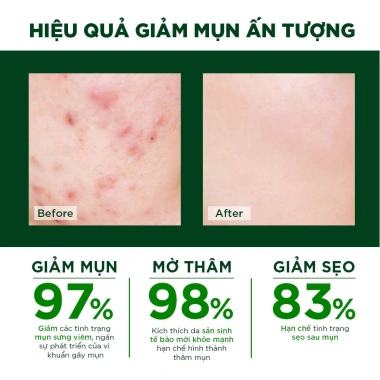 Kem Chấm Mụn Oribe 20g - Dưỡng da, giảm thâm sẹo, kiểm soát dầu nhờn, 55.800 VND 8 Kem Chấm Mụn Oribe 20g - Dưỡng da, giảm thâm sẹo, kiểm soát dầu nhờn, 55.800 VND 8