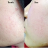 Kem Chấm Mụn Pair Acne W Cream Nhật Bản 24gr Giảm mụn, ngừa sẹo, giá 141k 6