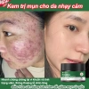 Kem chấm mụn serum BHA se khít lỗ chân lông, xóa mụn nhanh, dịu nhẹ chỉ 145.000 VND