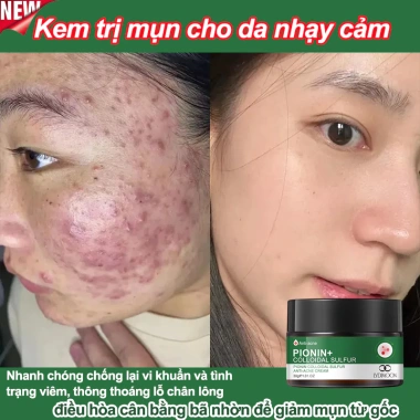 Kem chấm mụn serum BHA se khít lỗ chân lông, xóa mụn nhanh, dịu nhẹ chỉ 145.000 VND