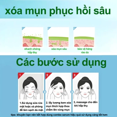 Kem chấm mụn serum BHA se khít lỗ chân lông, xóa mụn nhanh, dịu nhẹ chỉ 145.000 VND
