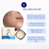 Kem Chăm Sóc Da Mụn IKI BEAUTI 18g - Giảm Mụn, Mờ Thâm, Trắng Sáng Da, Se Khít Lỗ Chân Lông, Giá Ưu Đãi 141.600 VND 4