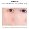 Kem Che Khuyết Điểm ABOUT TONE Cover Fit Mịn Da Tự Nhiên, Lâu Trôi 145k 5