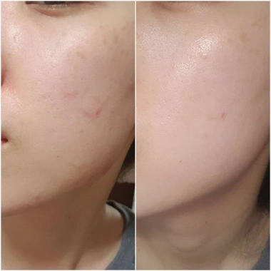 Kem chống nắng Centella Skin Air-fit SPF50+ 50ml rau má không nhờn giảm giá 249.000 VND