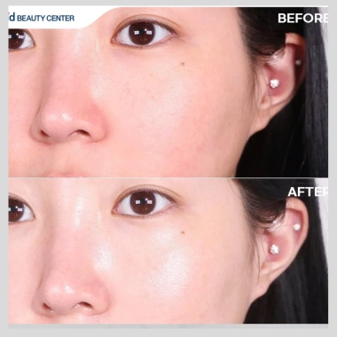 Kem chống nắng ID.AZ Dermastic SPF50+ PA++++ mỏng nhẹ 30ml giá ưu đãi 699.000₫ 2