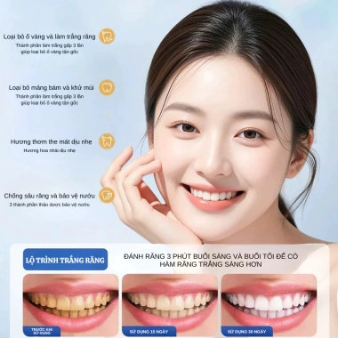 Kem đánh răng SP10 vị bạc hà – Trắng răng, sạch mảng bám, phù hợp gia đình, giá ưu đãi 39.999₫