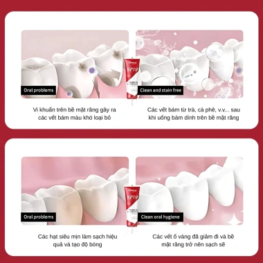 Kem đánh răng SP10 vị bạc hà – Trắng răng, sạch mảng bám, phù hợp gia đình, giá ưu đãi 39.999₫ 5 Kem đánh răng SP10 vị bạc hà – Trắng răng, sạch mảng bám, phù hợp gia đình, giá ưu đãi 39.999₫ 5