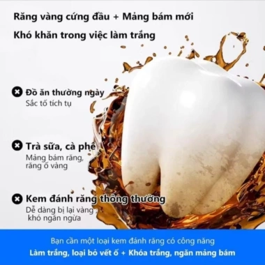 Kem đánh răng ThaiSmile SP10 - Trắng răng nhanh, bảo vệ nướu, giá 55.000đ 3