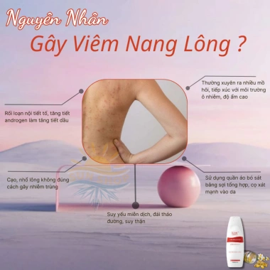 Kem Đào Thải Viêm Nang Lông Urea - Giảm Mụn Lưng Ngực, Dưỡng ẩm, Da Mềm Mịn Sun Sh 7