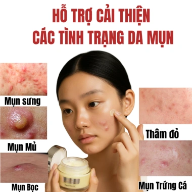 Kem Doctor Care Acnes Elimination 30g - Giảm Mụn Ẩn, Đầu Đen, Thâm, Kiểm Soát Dầu, Da Dầu 2