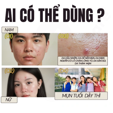 Kem Doctor Care Acnes Elimination 30g - Giảm Mụn Ẩn, Đầu Đen, Thâm, Kiểm Soát Dầu, Da Dầu 3