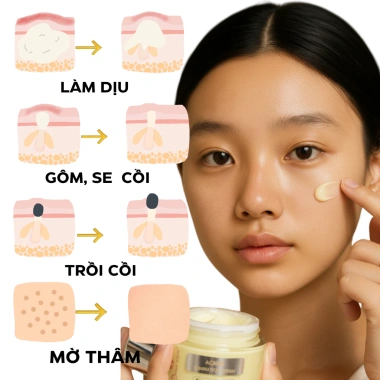 Kem Doctor Care Acnes Elimination 30g - Giảm Mụn Ẩn, Đầu Đen, Thâm, Kiểm Soát Dầu, Da Dầu 4
