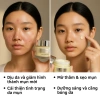 Kem Doctor Care Acnes Elimination 30g - Giảm Mụn Ẩn, Đầu Đen, Thâm, Kiểm Soát Dầu, Da Dầu 5