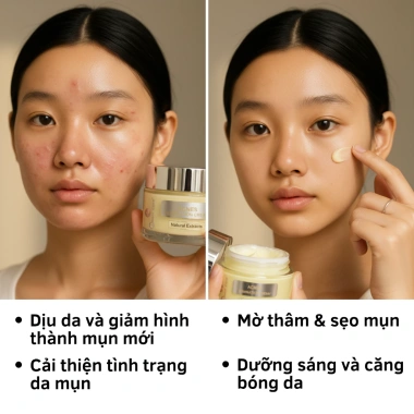 Kem Doctor Care Acnes Elimination 30g - Giảm Mụn Ẩn, Đầu Đen, Thâm, Kiểm Soát Dầu, Da Dầu 5