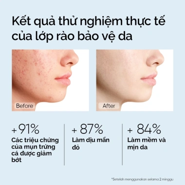 Kem dưỡng ẩm 5X Ceramide SKINTIFIC 30g - Phục hồi, tăng độ ẩm, giảm nẻ - 248k