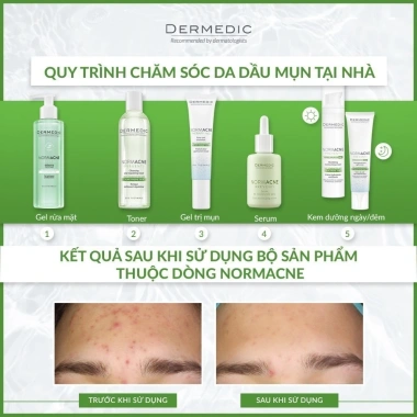 Kem dưỡng ẩm ban ngày Dermedic kiềm dầu normacne giảm mụn 40ml - 826.810₫ 4 Kem dưỡng ẩm ban ngày Dermedic kiềm dầu normacne giảm mụn 40ml - 826.810₫ 4