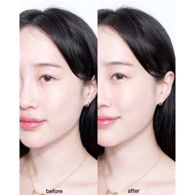 Kem dưỡng ẩm chuyên sâu Vemontes Hyccine Cream 100ml - Giá 822.970₫, giảm 20%