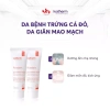 Kem dưỡng ẩm da giãn mao mạch Trứng cá đỏ Ivatherm Rosederm Cream 30ml - Giá 890.400₫ 6