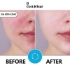Kem Dưỡng Ẩm Phục Hồi Da B3+B5 Collagen Co&Klear 50ml - Cấp Nước, Da Căng Bóng, Giá 375.000 VNĐ 6
