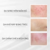 Kem dưỡng ẩm & phục hồi da Program Skin Repair Cream 45g - Giá ưu đãi 519k, dưỡng ẩm sâu, tái tạo 3