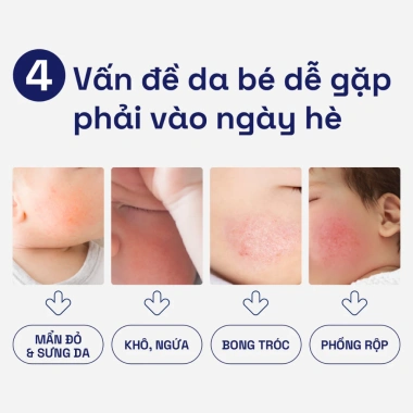 Kem dưỡng ẩm và làm dịu cho bé Cetaphil Baby Soothing Moisturising Cream 100g - Giá 185.000 4 Kem dưỡng ẩm và làm dịu cho bé Cetaphil Baby Soothing Moisturising Cream 100g - Giá 185.000 4