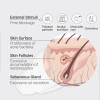 Kem dưỡng Azelaic Acid 10% The Ordinary - Chống oxy hoá, sáng da, tẩy tế bào chết, giá 198.000 VND 2